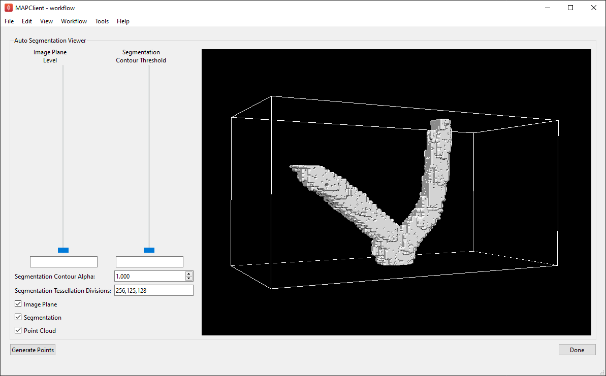 ../../_images/auto-segmentation-initial.png