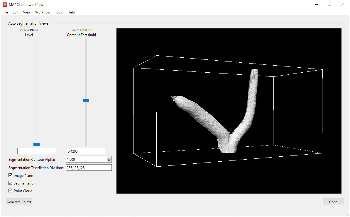 ../../_images/auto-segmentation-threshold.png